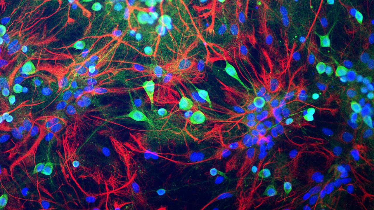 Neuroscienze, linguaggio e giustizia penale